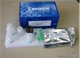 供应用于的铜兰蛋白（CP）测定试剂盒图片