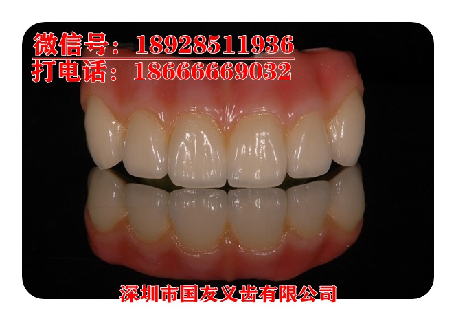 深圳厂家直销德国泽康全瓷牙的价格 全瓷让你离健康更近一步图片