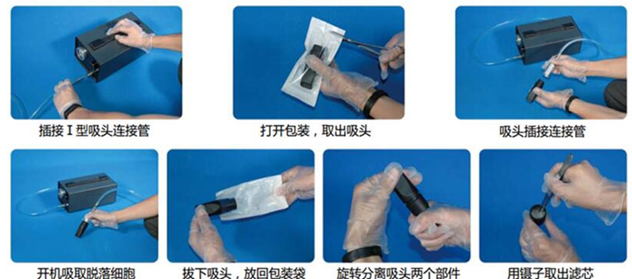 北京市便携式脱落细胞负压提取仪厂家