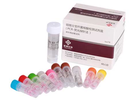 圣湘 结核分枝杆菌核酸检测试剂盒（PCR-荧光探针法）图片